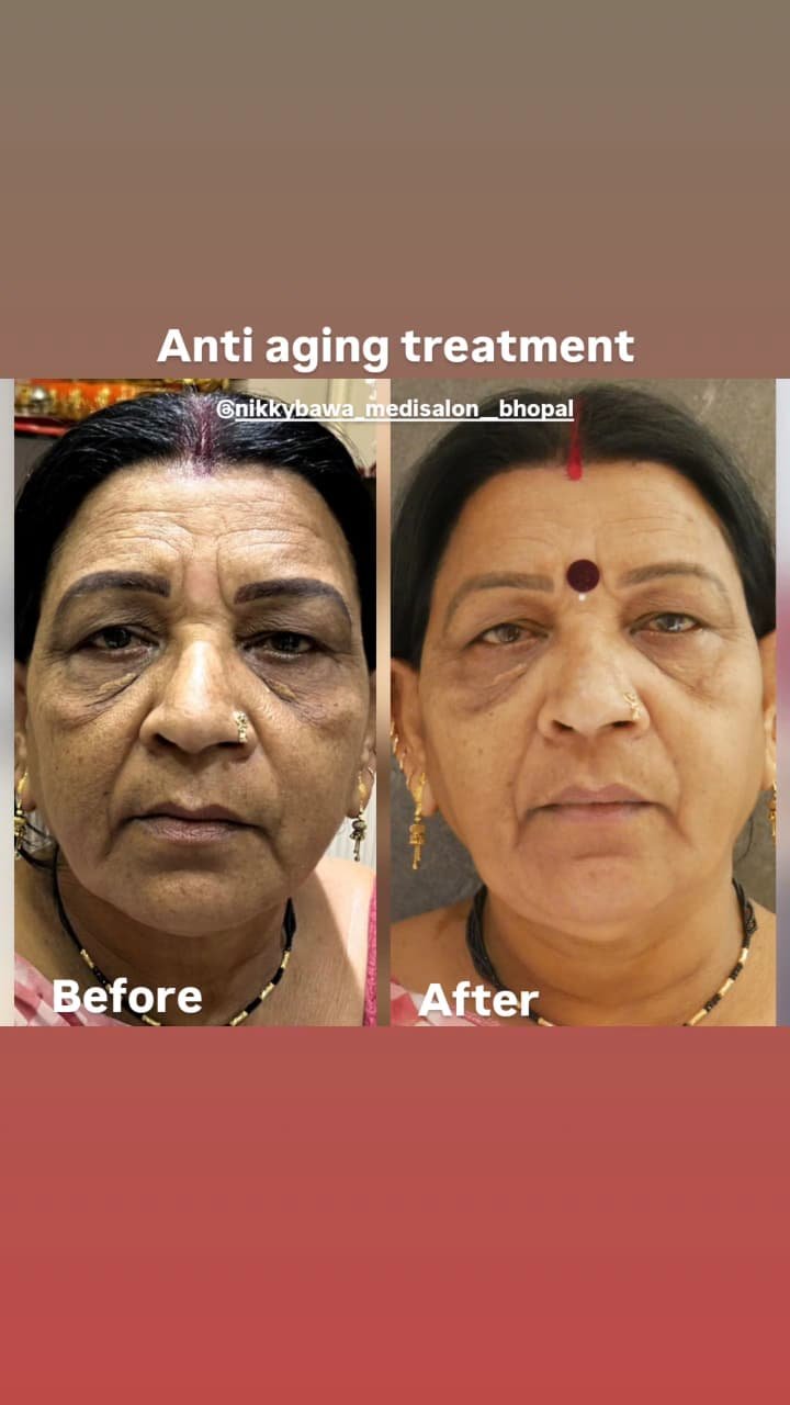 anti-ageing-before-after-1