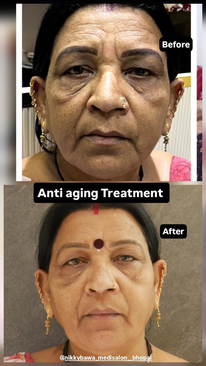 anti-ageing-before-after-2