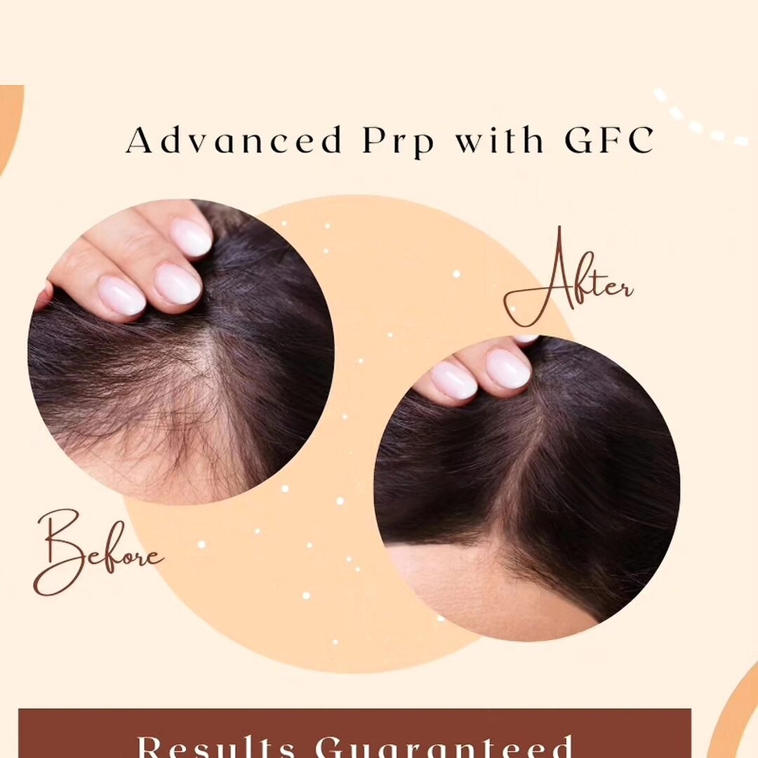 Modern Hair Regrowth and Styling Solutions for Women and Men 2025