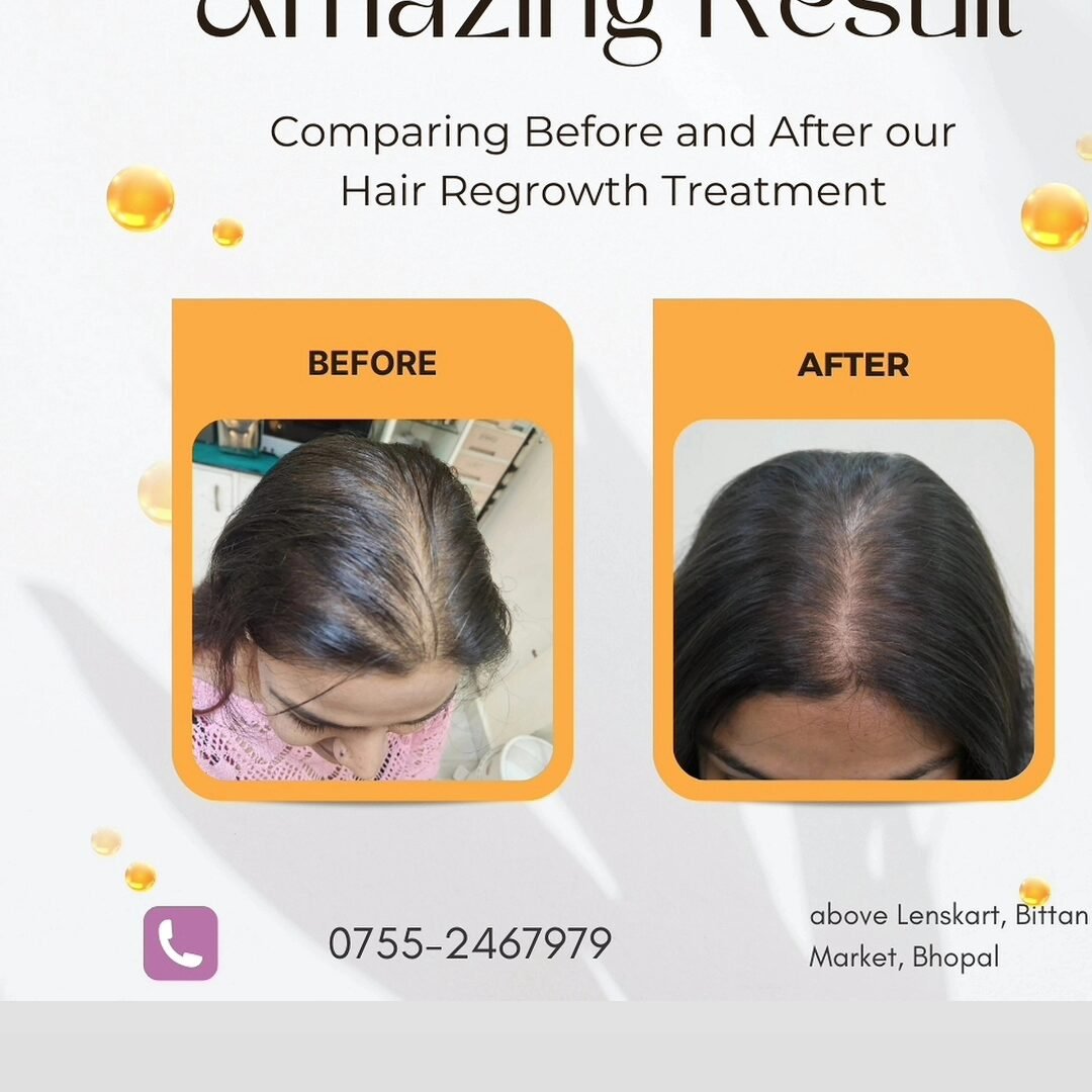 Top 5 Hair Treatments To Fight Hair Loss